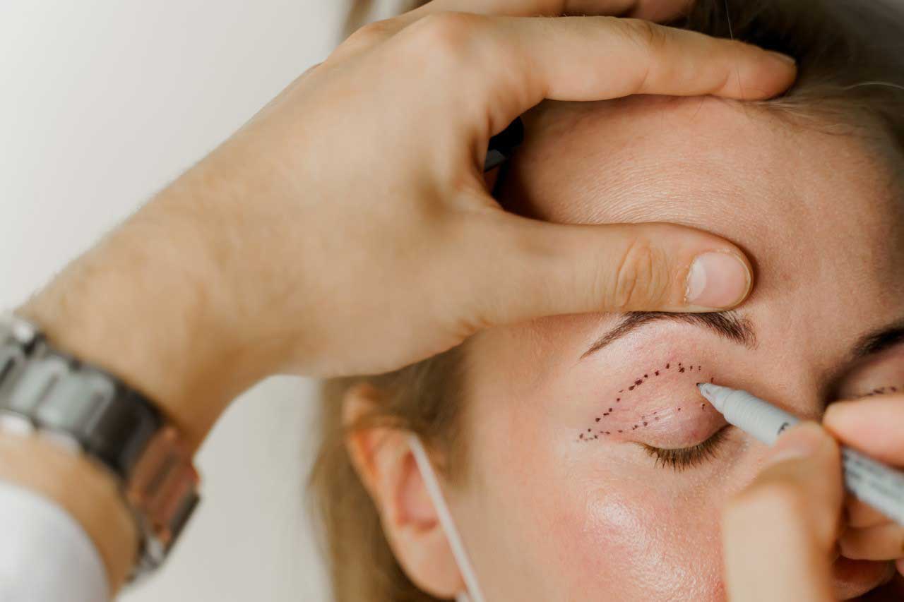 eye surgery